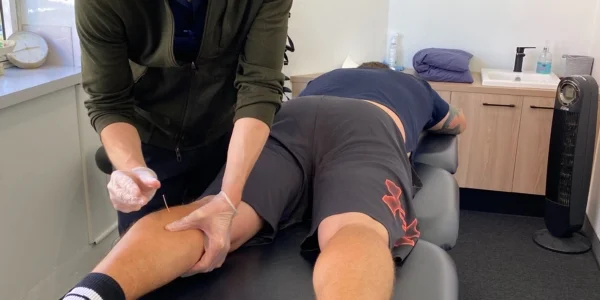 Sydney Physiotherapist Performs Dry Needling Physio