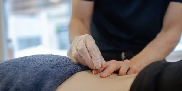 Dry Needling Waverley